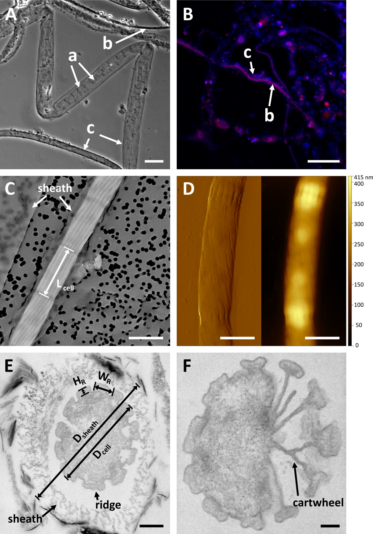 Microscopy images of Cable Bacterium strain YB6 showing filament structures and ultrastructure